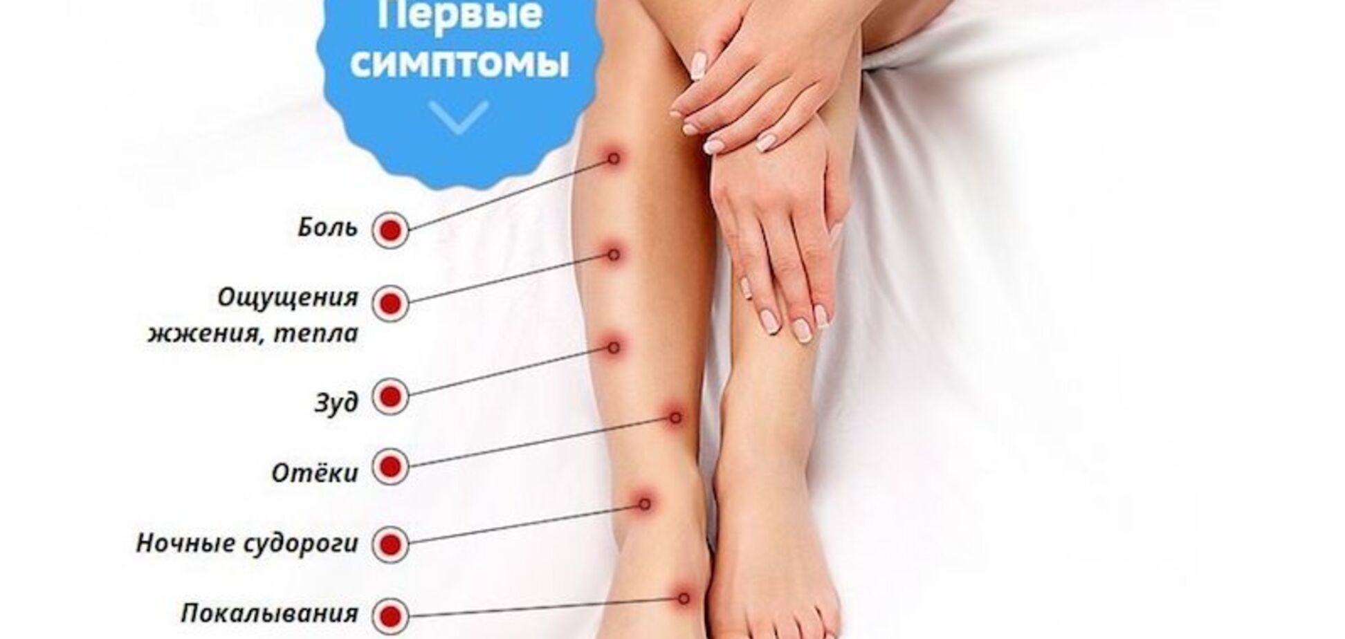 Заболевания вен нижних конечностей: современные подходы к лечению и профилактике