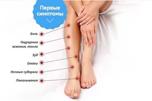Заболевания вен нижних конечностей: современные подходы к лечению и профилактике