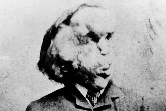 Спустя 130 лет поисков найдена могила человека-слона