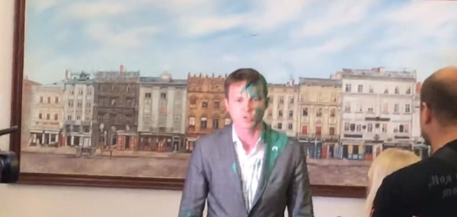 Опіки намалювали? Заступник Садового втрапив у гучний скандал