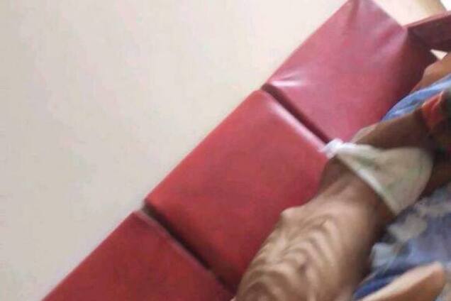 У Дніпрі хворого з гангреною покинули помирати в коридорі лікарні: моторошні кадри