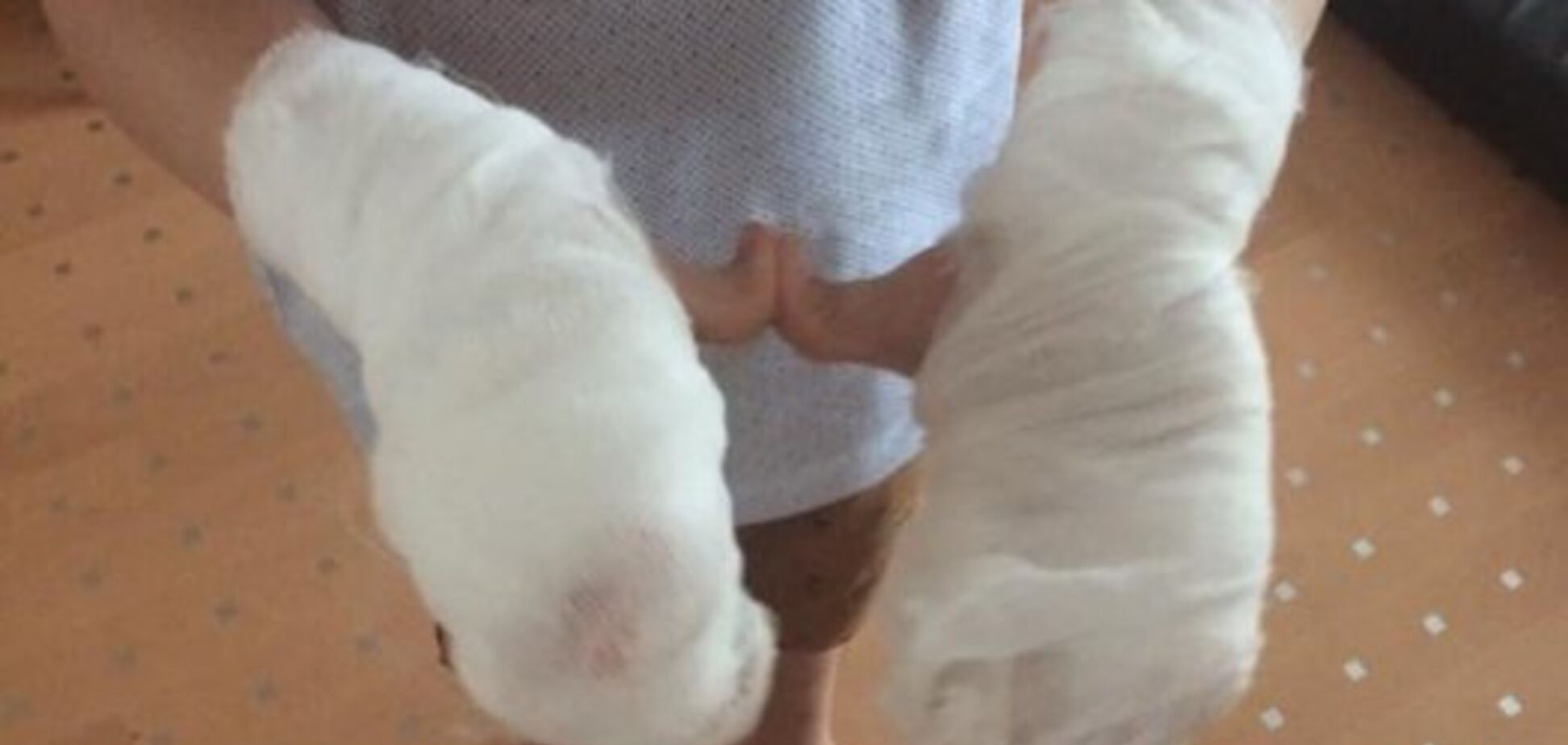 'Вылили жидкий азот': в Николаеве аниматоры травмировали ребенка на празднике