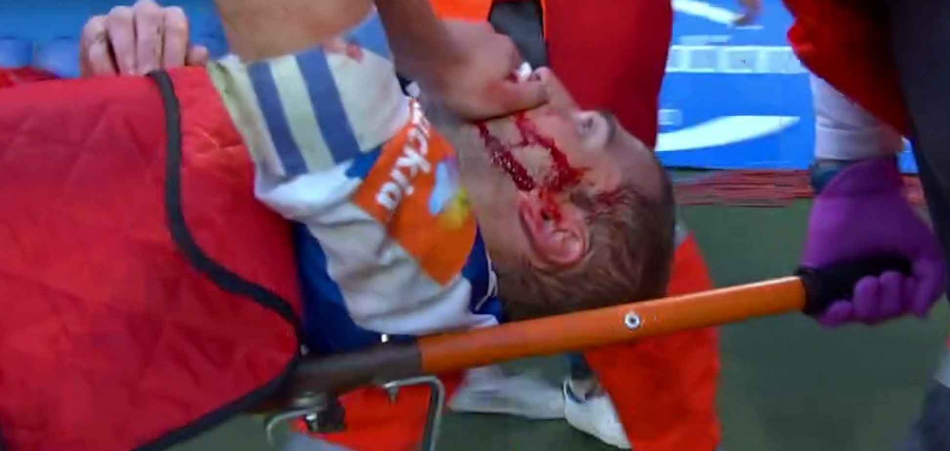 Футболіст в'їхав прямою ногою в обличчя супернику: страшне відео