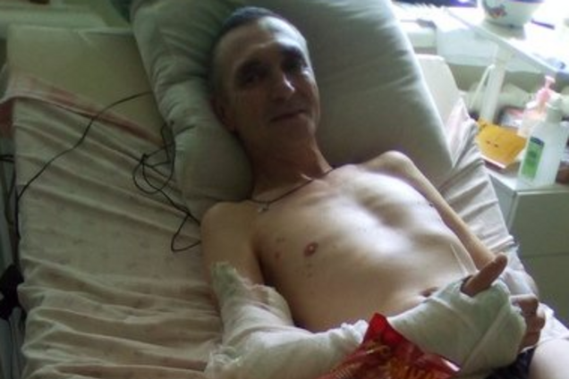 'Нех*й шастати!' Росія кинула напризволяще безногого терориста на Донбасі