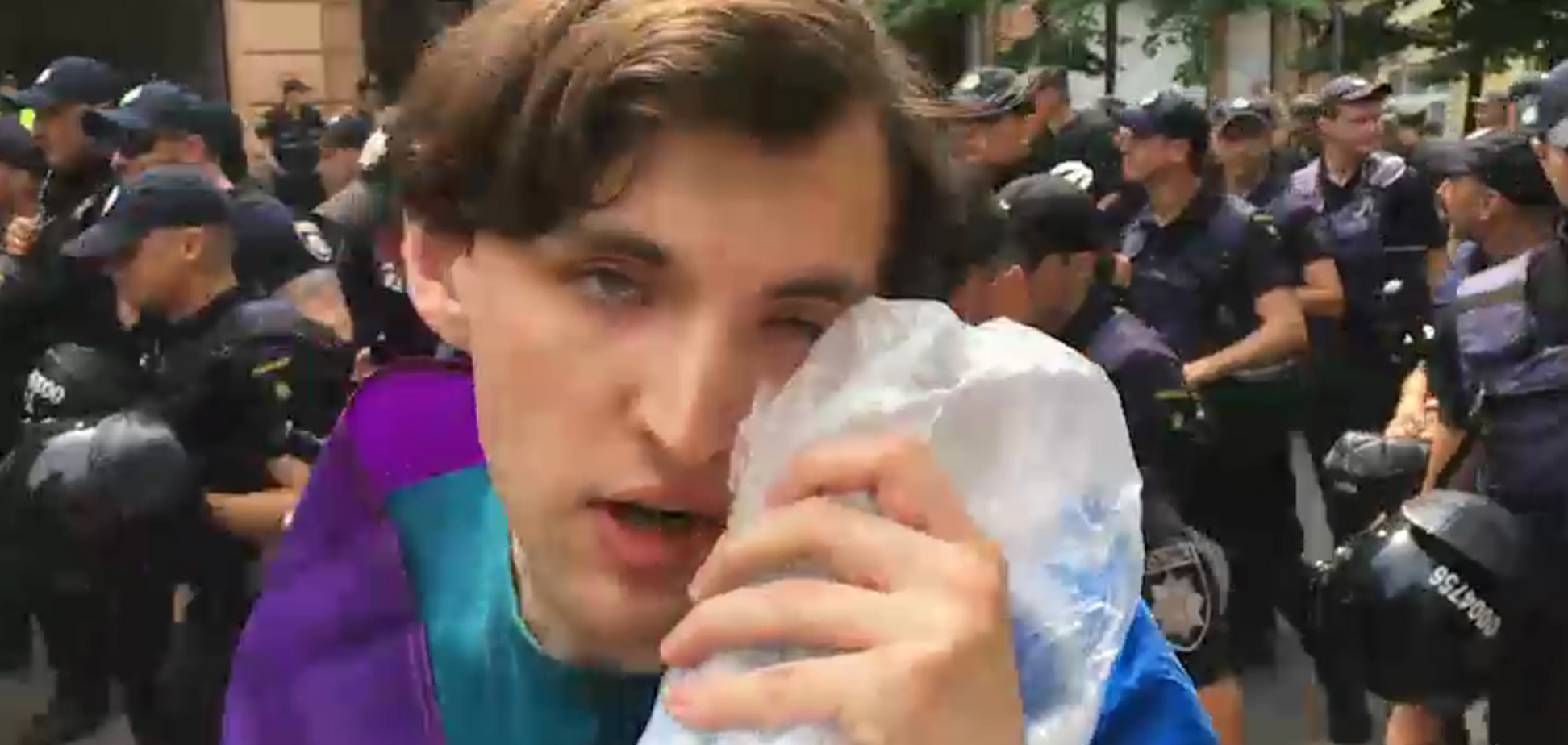 Марш рівності у Києві: журналіст ледь не позбувся ока через яйце