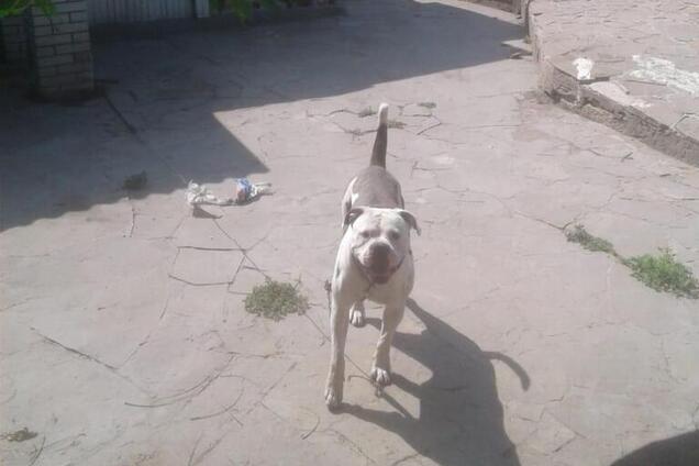 Перелом плеча і рвані рани: під Києвом бійцівський пес напав на перехожу