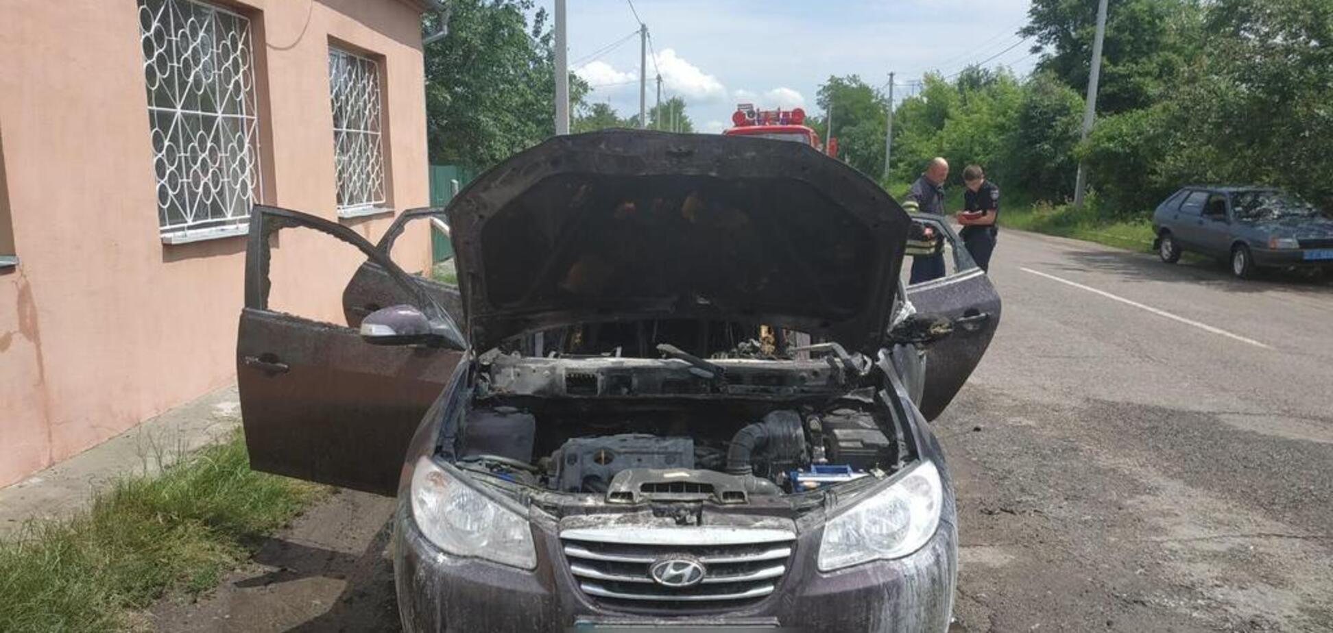 Под Киевом в результате взрыва обгорел ребенок: первые детали ЧП