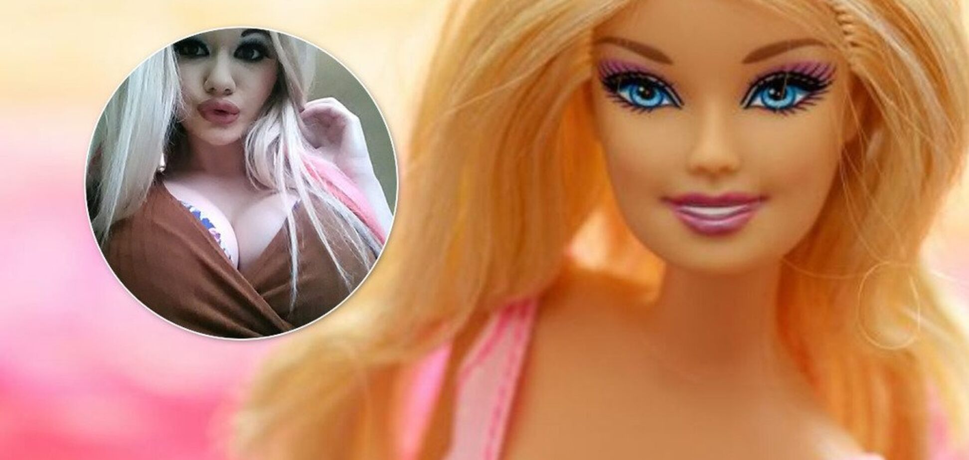 Хотела стать Барби: жертва пластических операций ужаснула внешним видом. Фото до и после