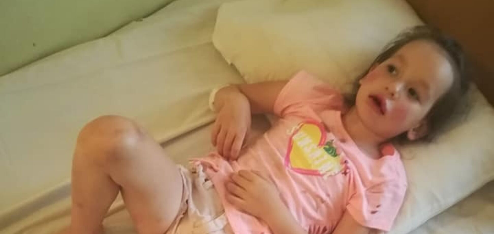 Вибив зуби, зашивали щелепу: у Києві велосипедист збив маленьку дитину і втік