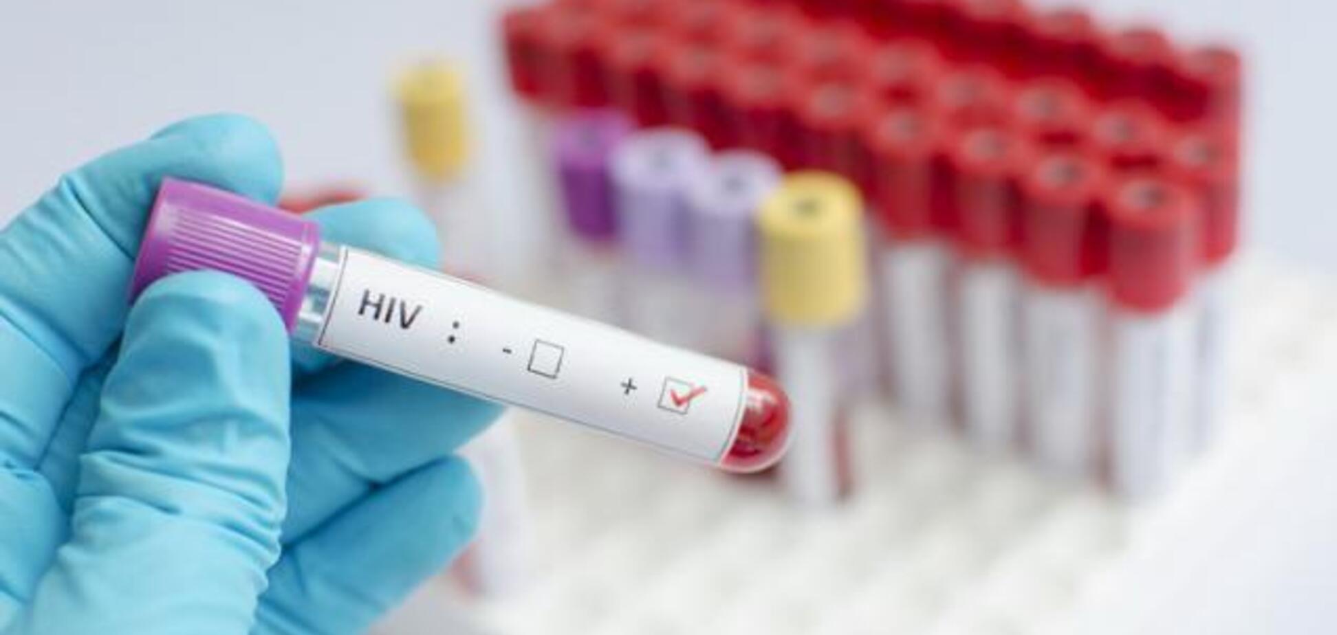 'Нужно всего 15 минут': новый тест на ВИЧ одобрили в ВОЗ
