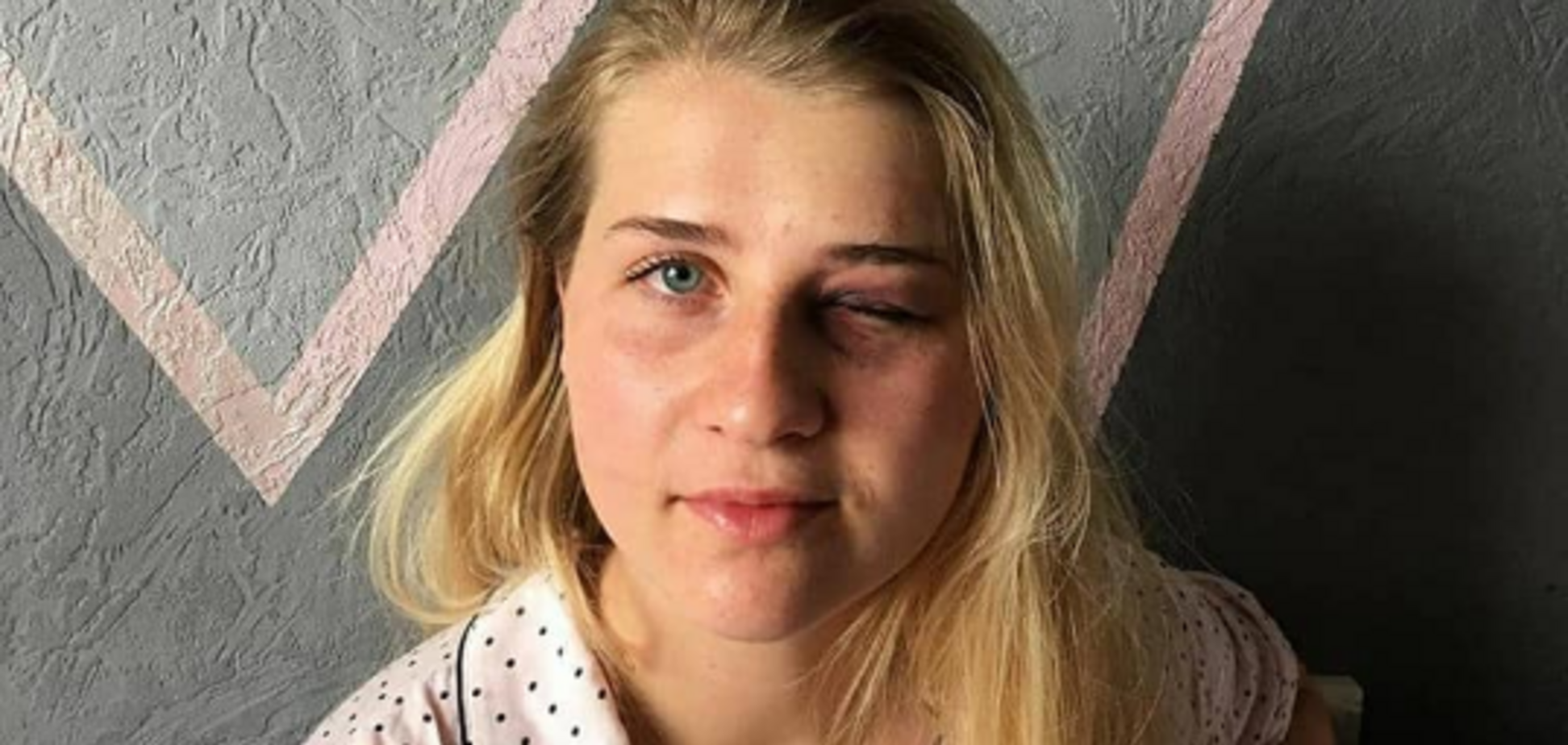 'Он меня убивает!' Украинка поразила сеть душераздирающей историей о нападении