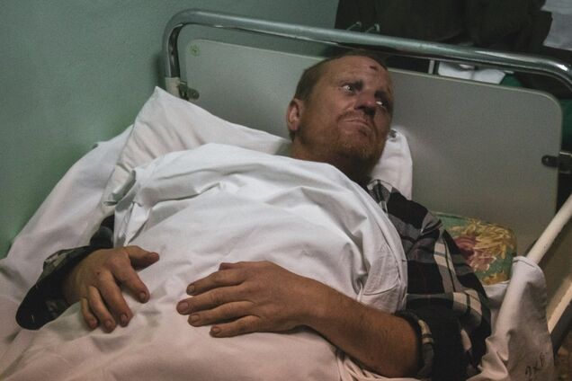 Хотел умереть: в Киеве избили и ограбили туриста из Ирландии