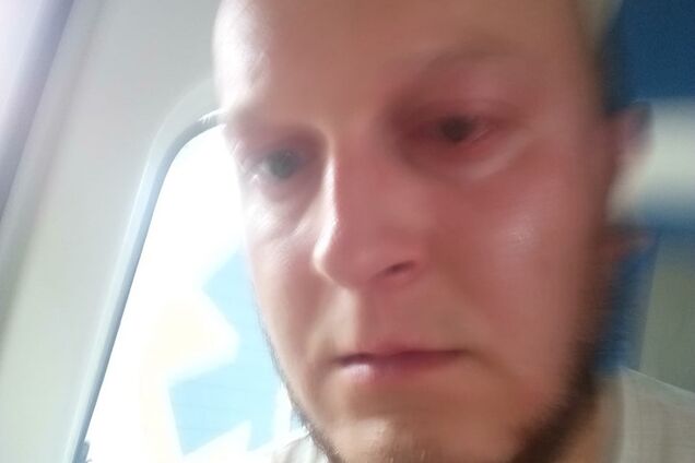 Получил химический ожог: в Ривне 'титушки' Шария напали на АТОшника