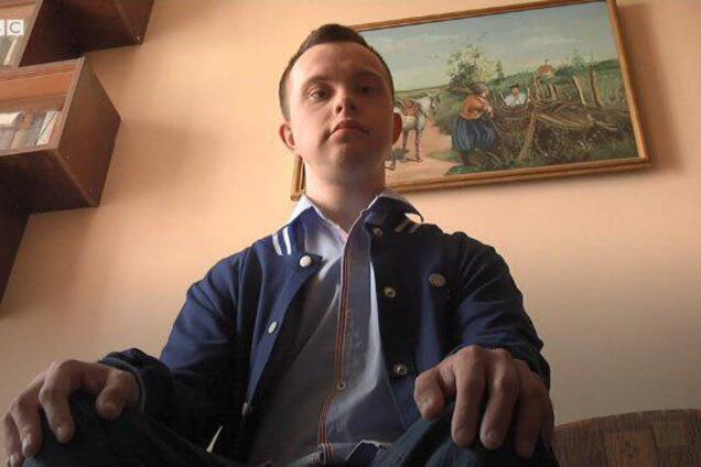 Перший в Україні бакалавр із синдромом Дауна шукає роботу. Відео