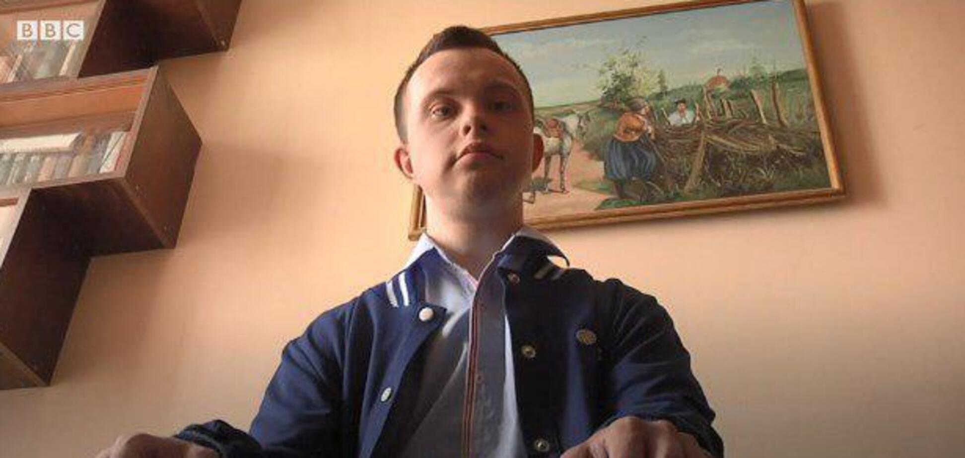 Первый в Украине бакалавр с синдромом Дауна ищет работу. Видео
