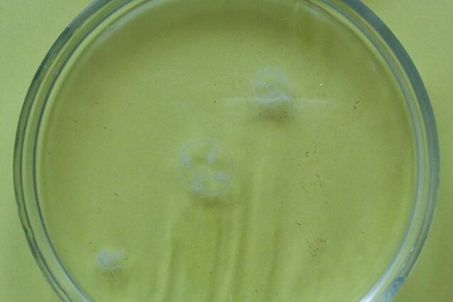 В Днепре заметили медуз