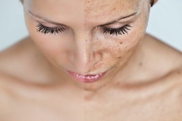Как уберечь свое лицо на отдыхе: основные правила ухода за кожей