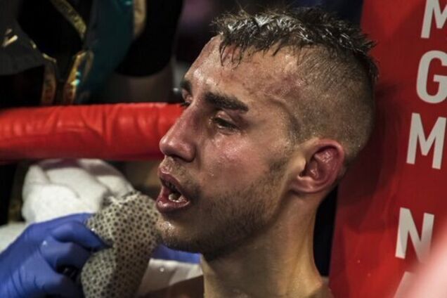 'Огидна!' Російський експерт назвав причину смерті Дадашева