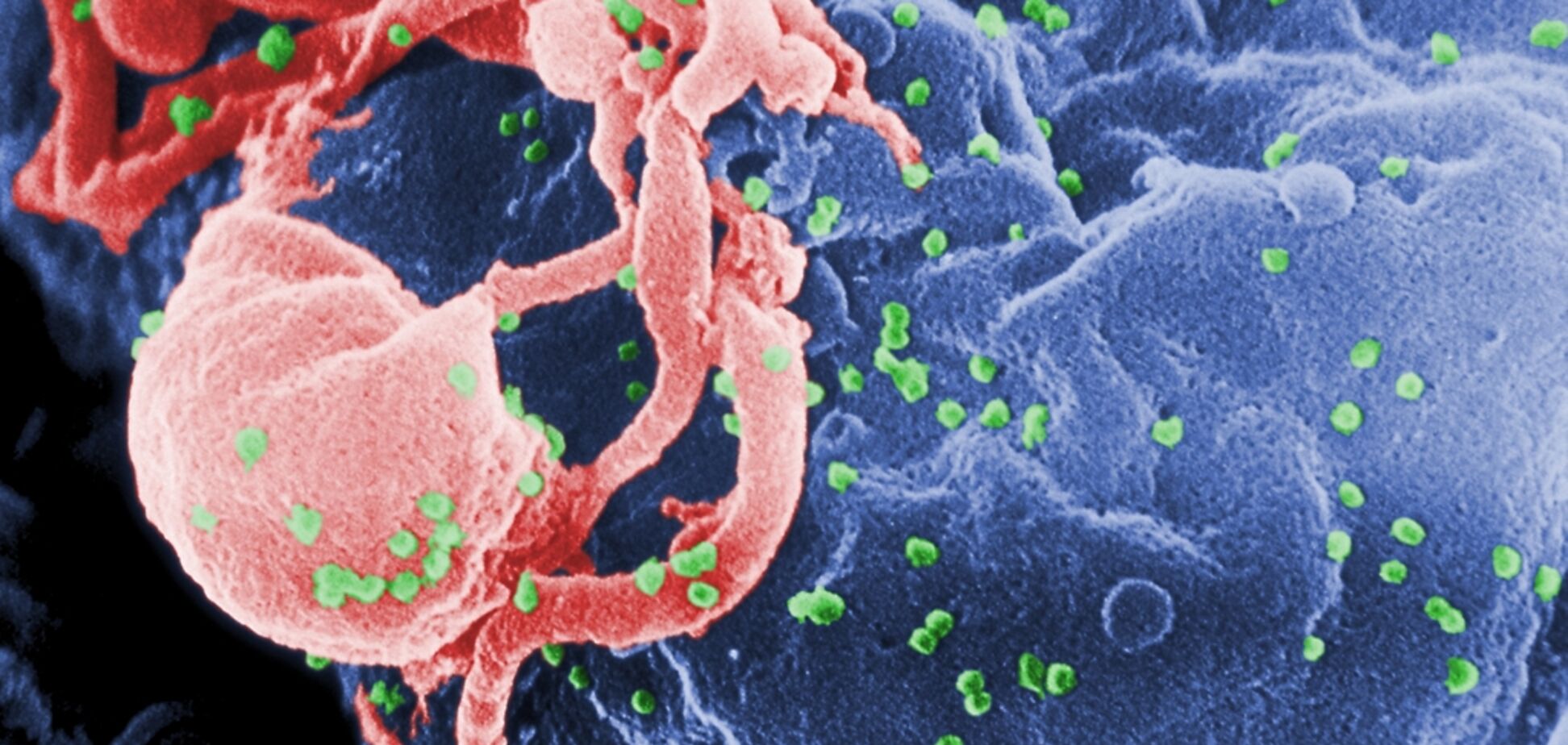 Новий засіб самозахисту! Розроблено інноваційний метод профілактики ВІЛ