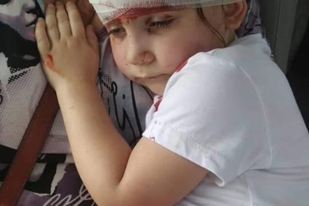 'Зашиють і все!' На Івано-Франківщині трапилася жахлива трагедія з дитиною. Фото 18+