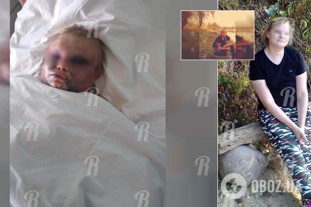 'Вырвали волосы, прыгали на лице': в России трое парней использовали женщину, как боксерскую грушу. Фото 18+