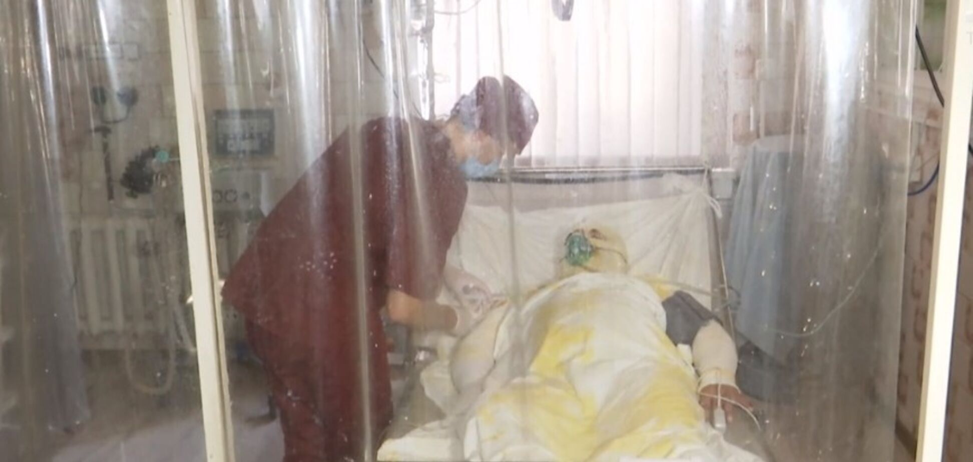 Сгорело 65% тела: бойцу ООС срочно нужна помощь