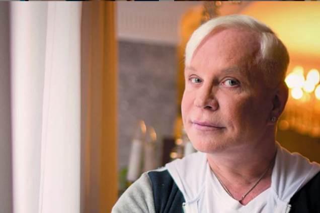 'Улучшений нет': тяжело больной Моисеев испугал внешним видом