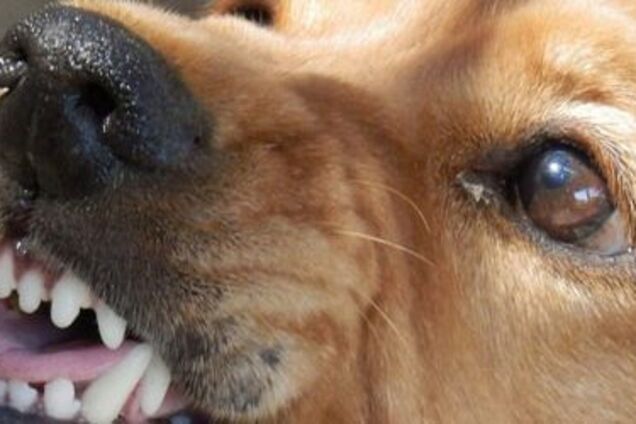 Кривава помста: у Дніпрі невідомий нацькував собаку на сім'ю з дитиною