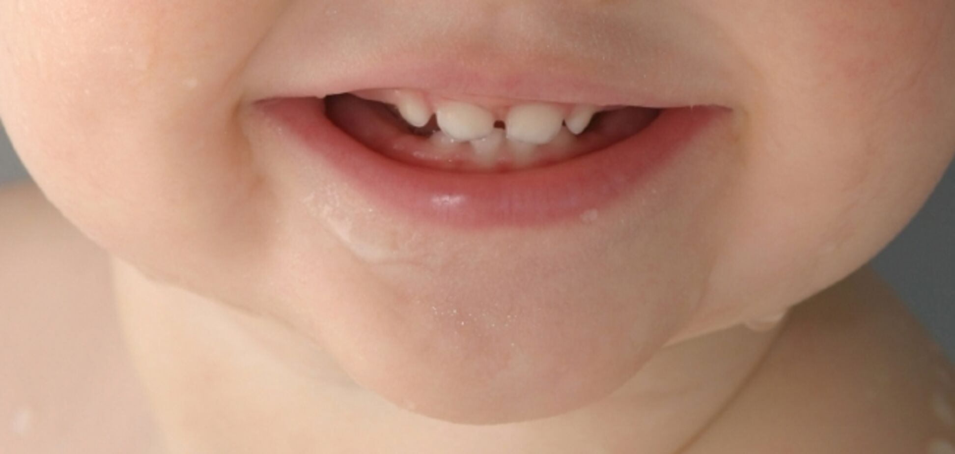 У ребенка долго не растут молочные зубы: что делать
