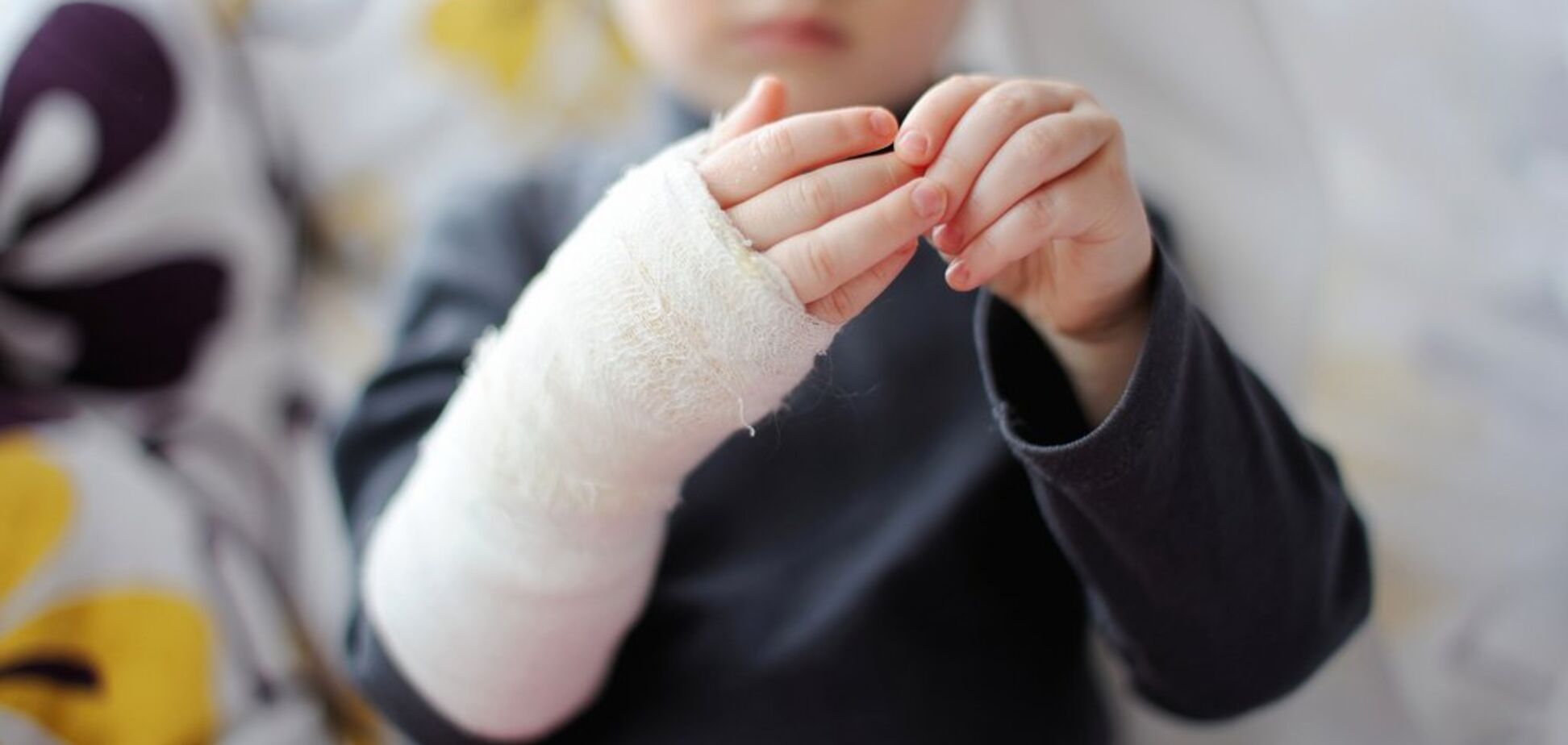 Ребенок с ожогом