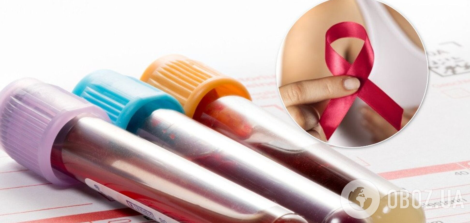 Новый анализ крови эффективнее обнаруживает рак молочной железы