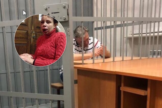 Задержание Грымчака связали с нападением на Черновол