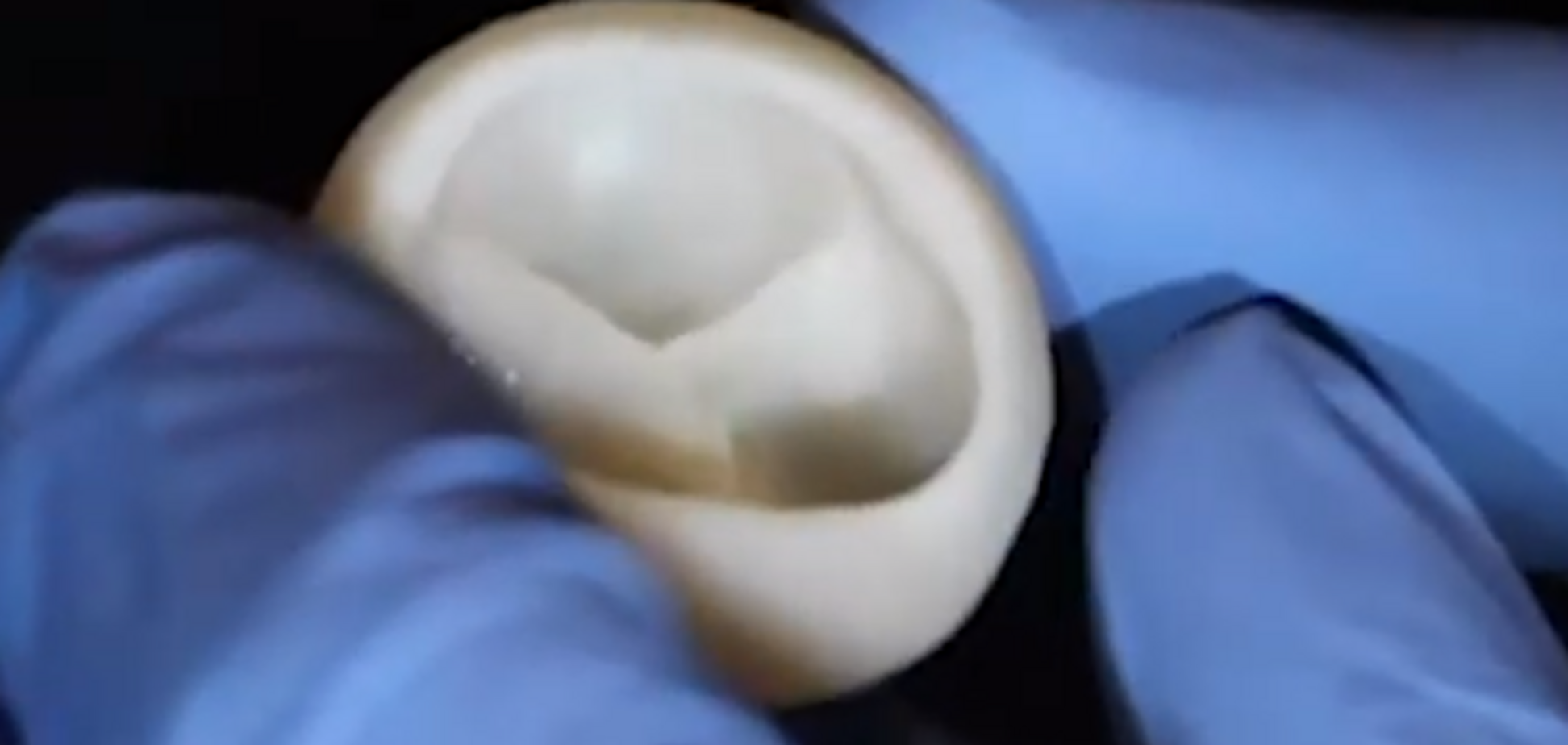 Ученым США удалось напечатать на 3D-принтере клапан для сердца. Видеофакт