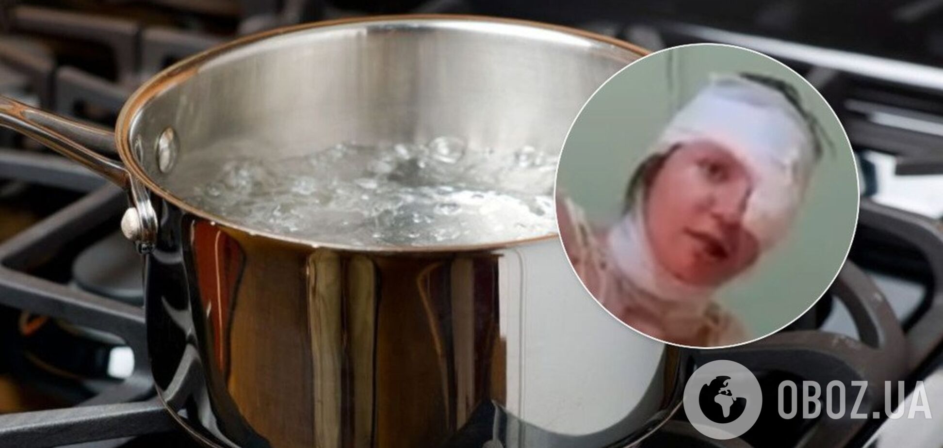 У Запоріжжі чоловік облив дружину окропом: з постраждалою трапилася нова трагедія