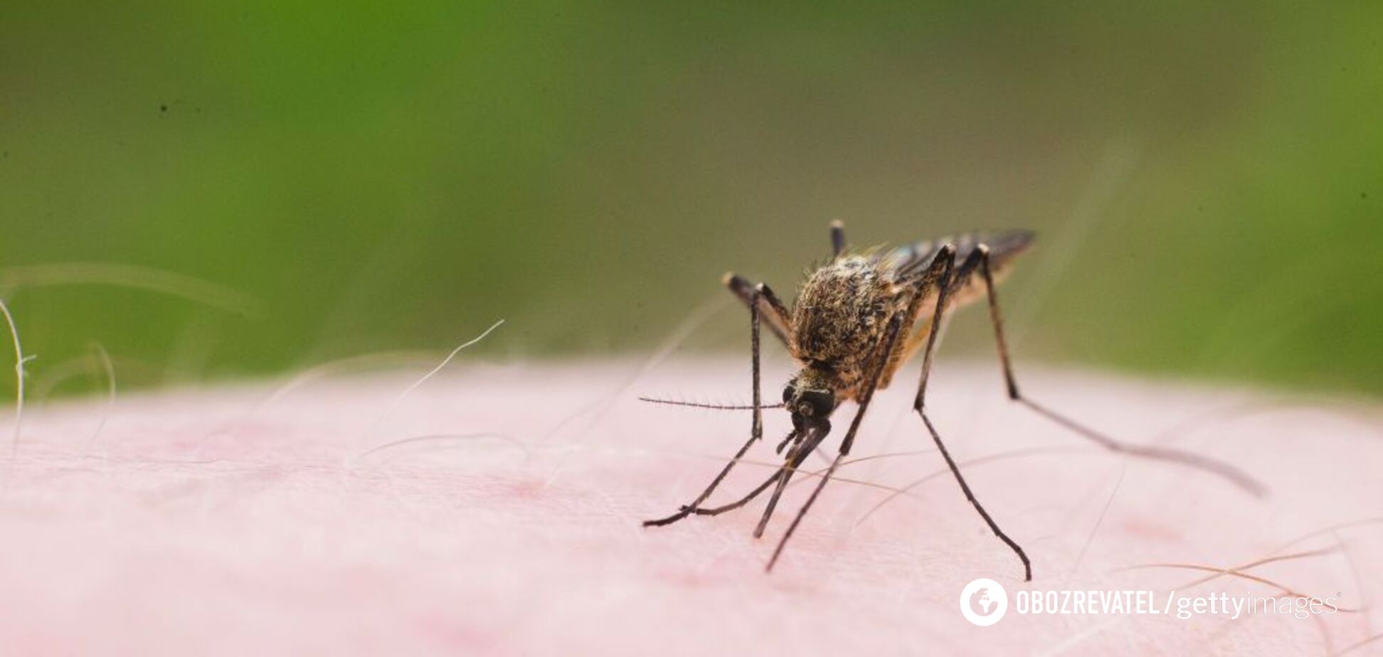 После укуса комара у девушки остановилось сердце: названа болезнь