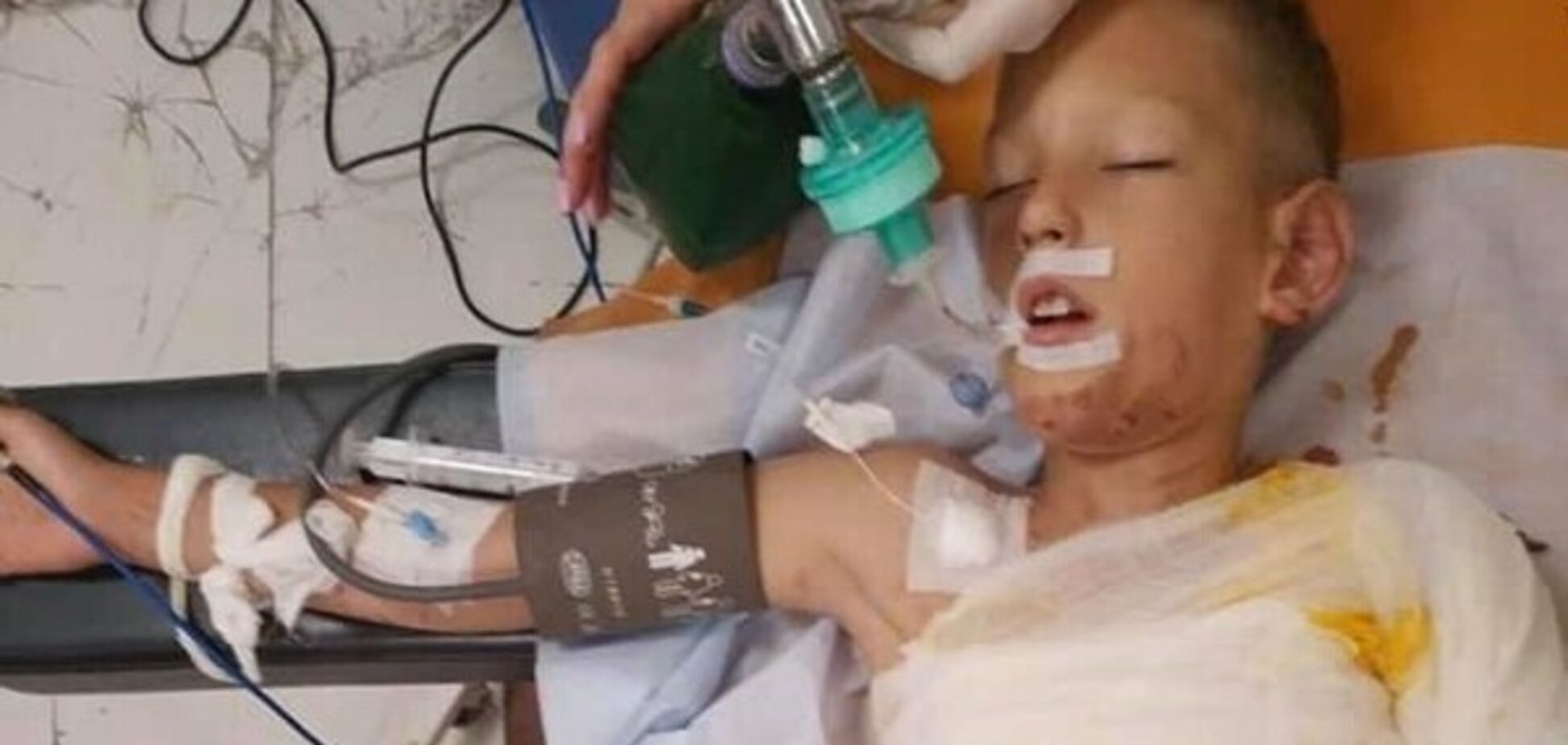 В Днепре подожгли 8-летнего ребенка: появились жуткие подробности