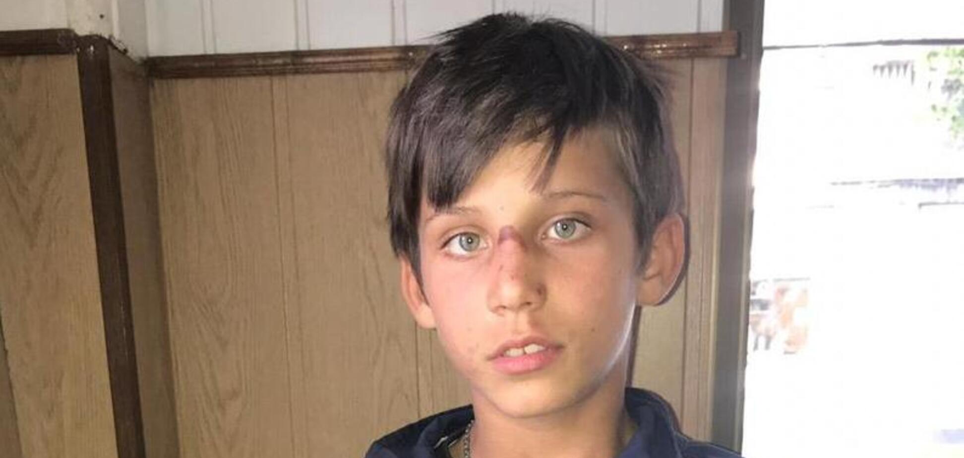 В Днепре из больницы исчез подросток: опубликованы особые приметы. Обновлено