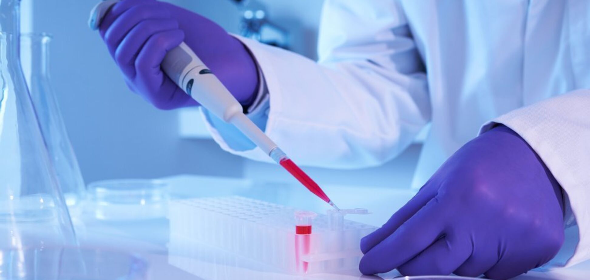 Точніше на 94%: розроблено новий аналіз на хворобу Альцгеймера