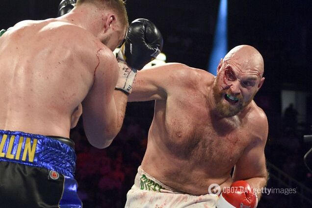 Похмілля у Вегасі: Ф'юрі після бою 'зашив' обличчя і відзначив перемогу в казино