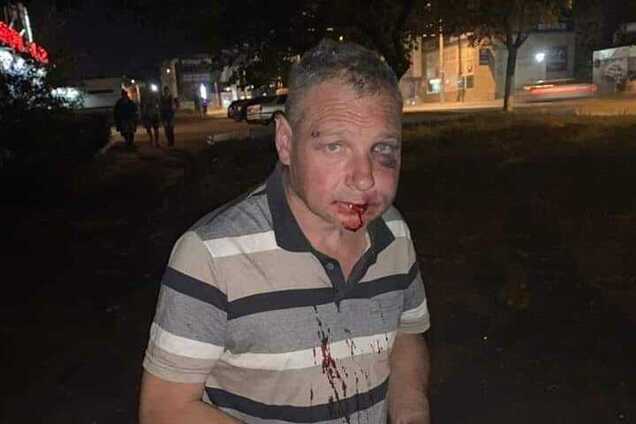 В Днепре повесился живодер, издевавшийся над собакой