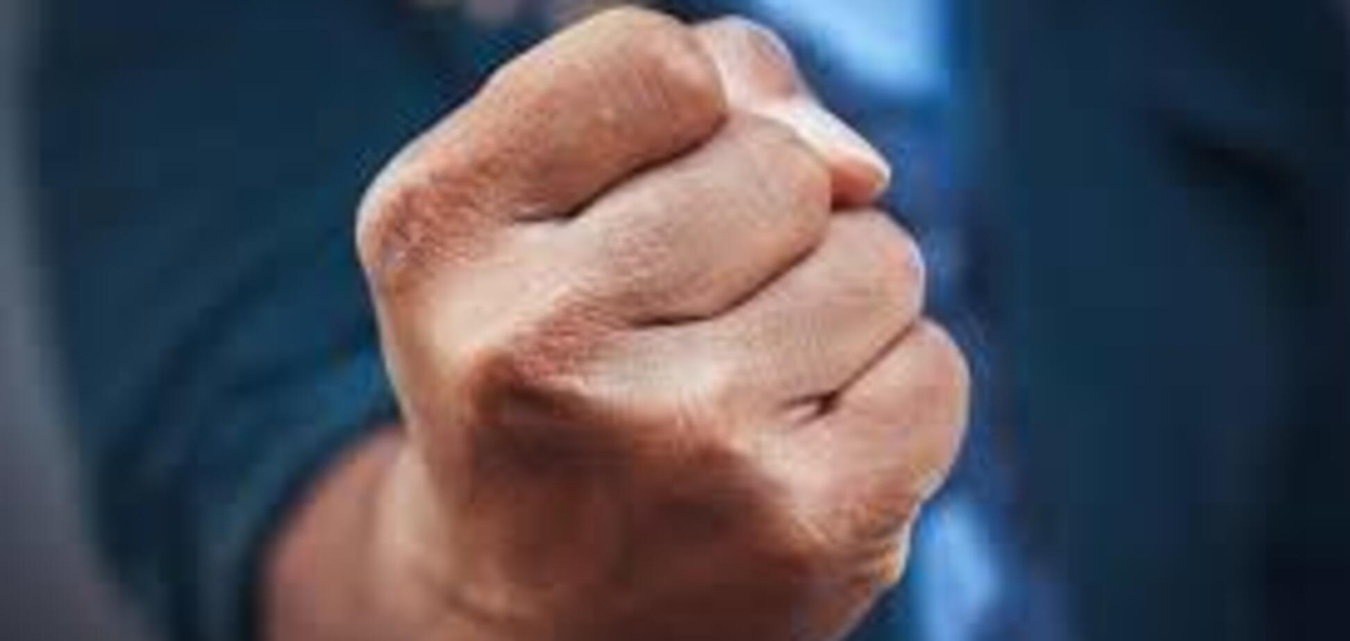 Под Днепром жестоко избили прокурора