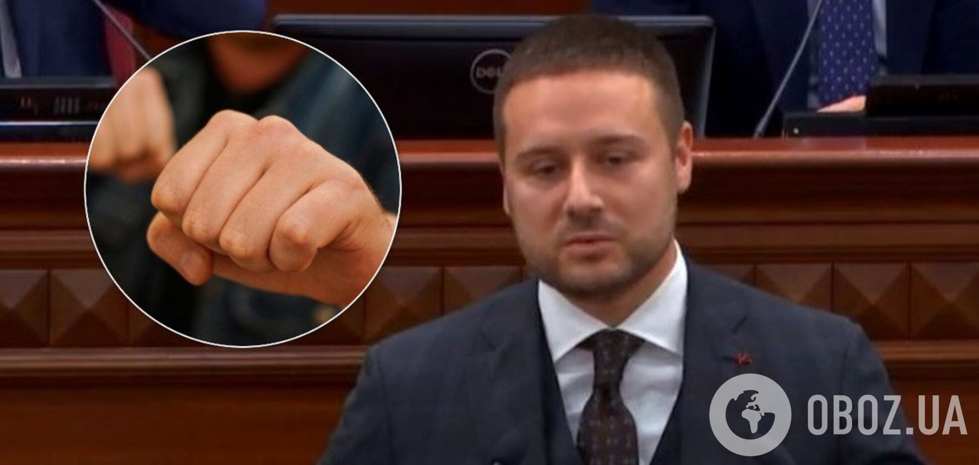 В Киеве жестоко избили замглавы КГГА