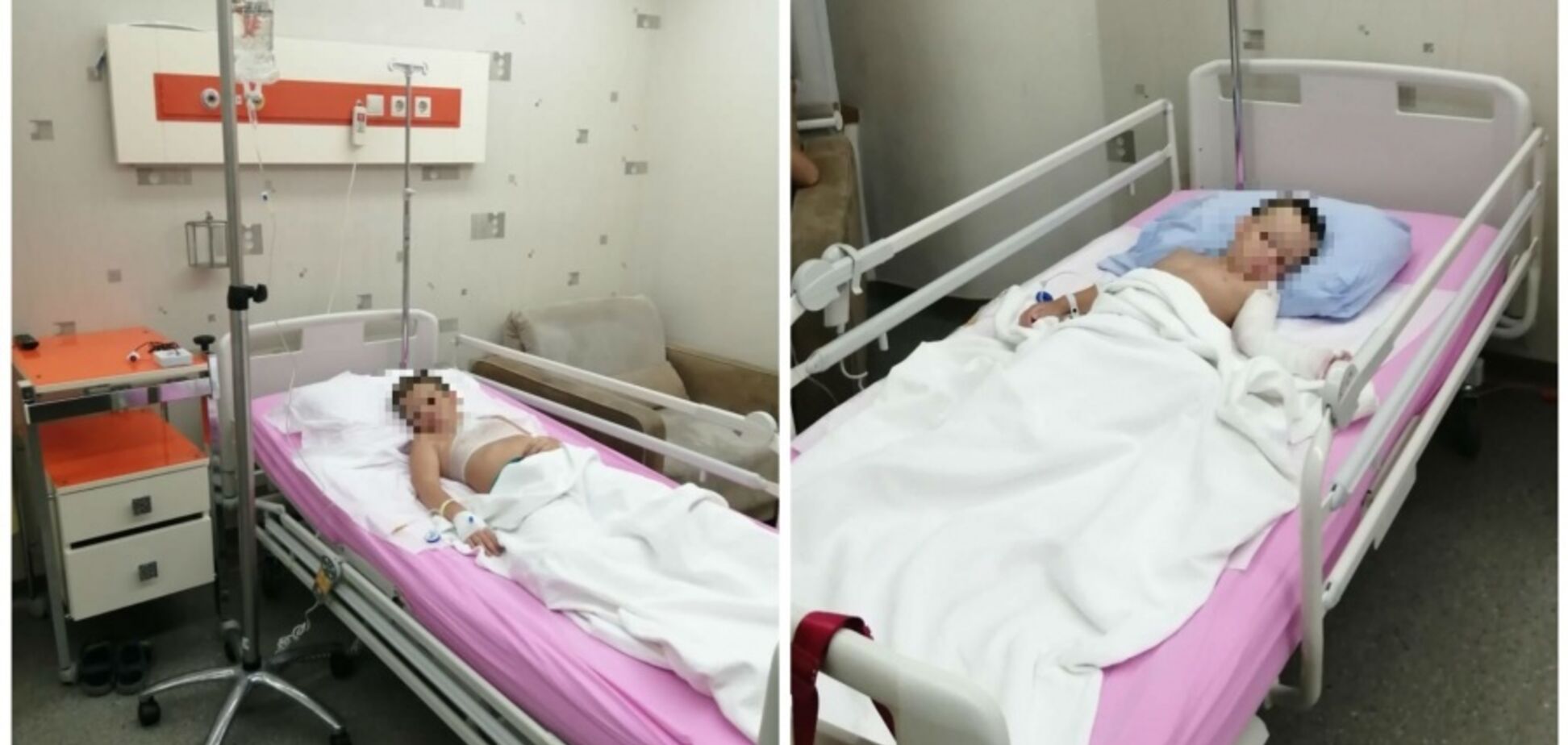 'Це було пекло, дитина кричала!' На курорті Туреччини дітей із Росії облили палаючою олією