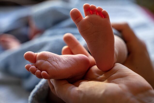 В Индии родилась девочка с 4 ногами и 3 руками