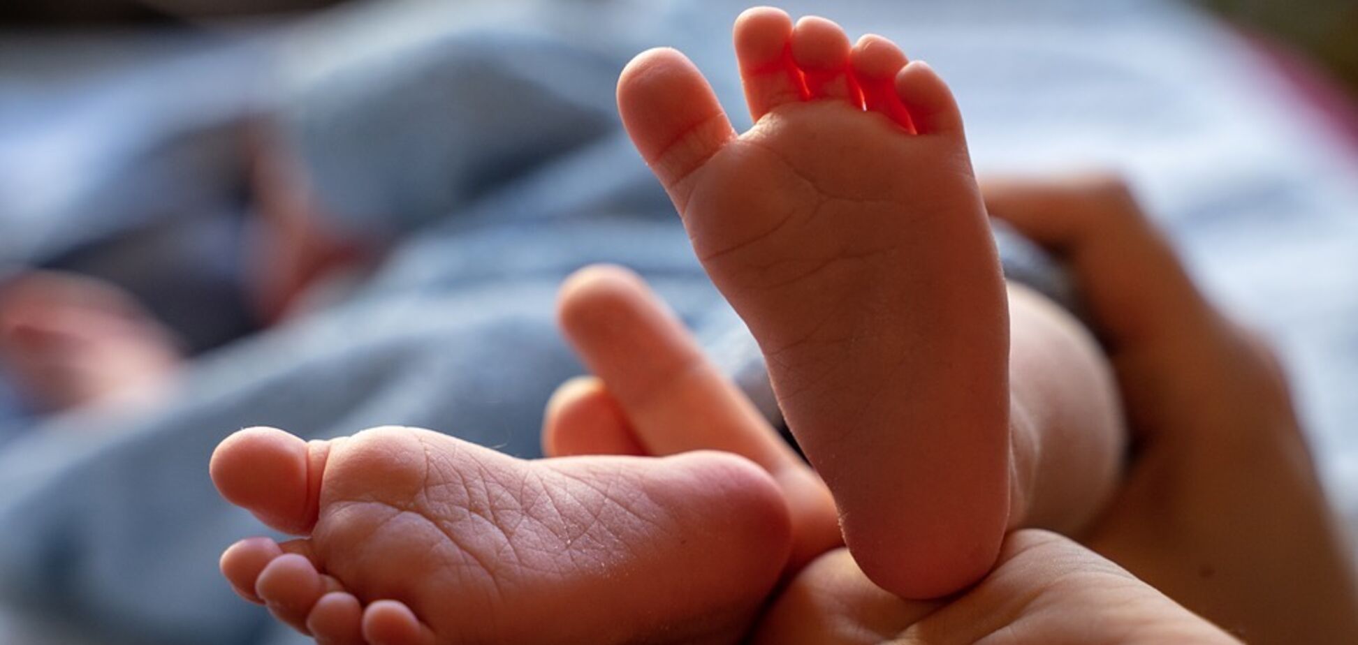В Індії народилася дівчинка з 4 ногами і 3 руками