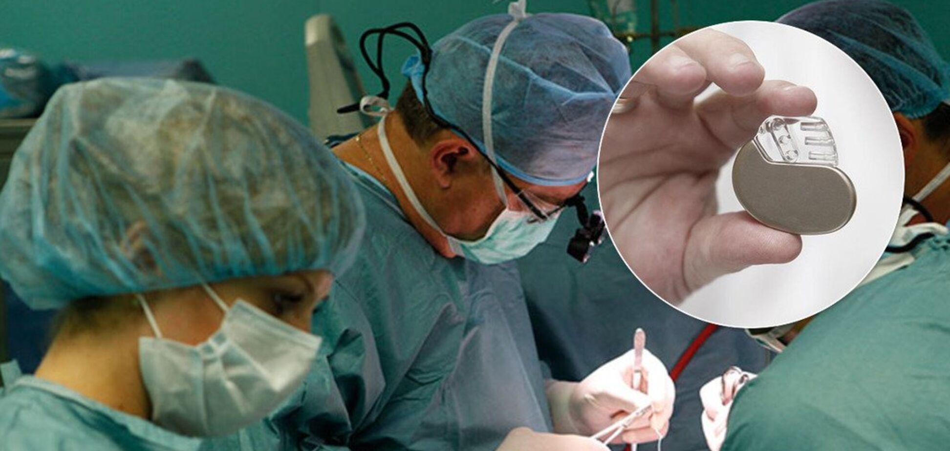 В Україні закінчилися безкоштовні кардіостимулятори: як це ''вдарить'' по пацієнтах