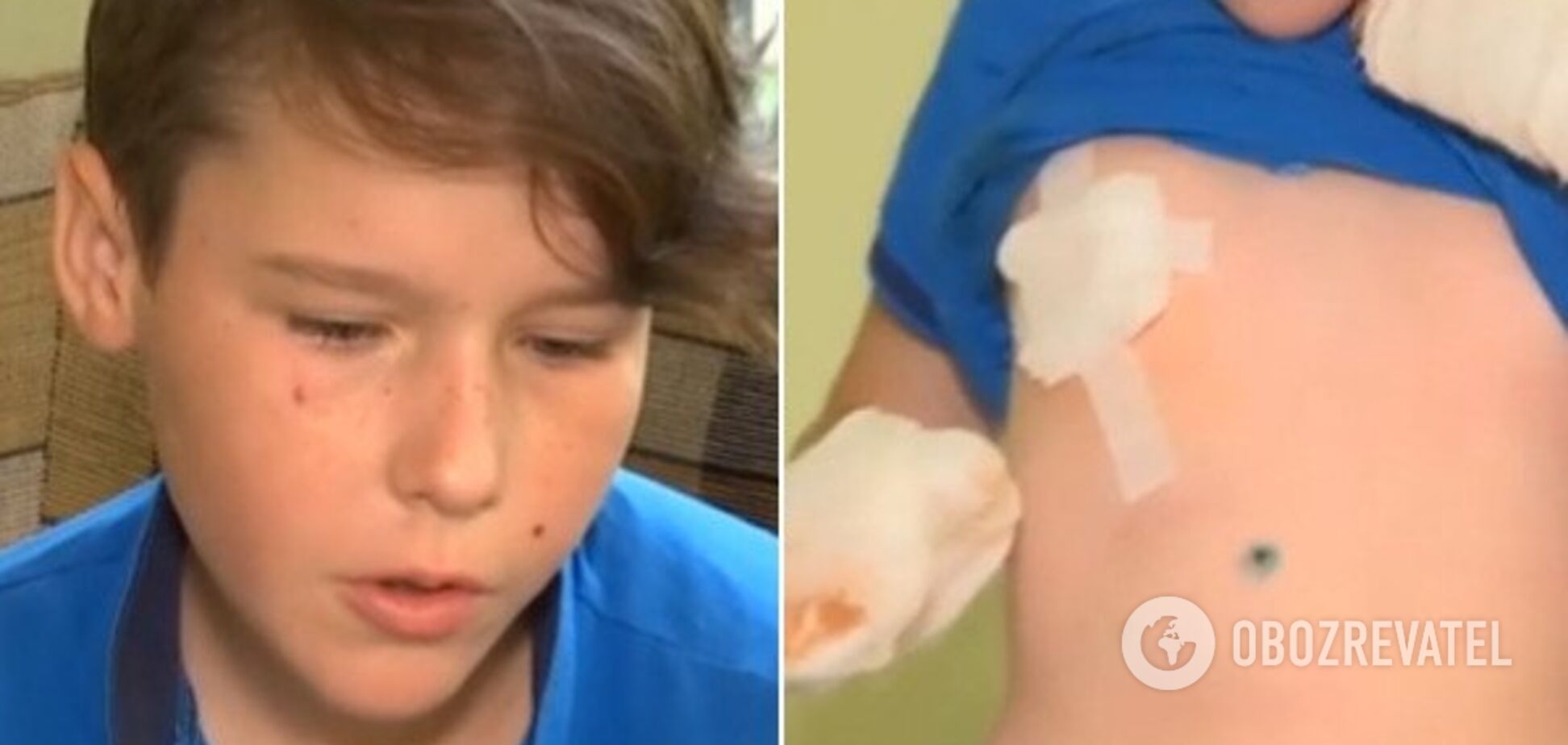 На Одесщине петарда взорвалась в руках школьника