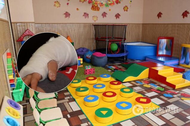 В российском детском саду ребенку со сломанной ногой не вызывали скорую 2,5 часа