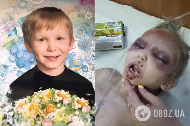 Колола иголкой и запрещала плакать: на Днепропетровщине мать зверски издевалась над ребенком. Фото 18+