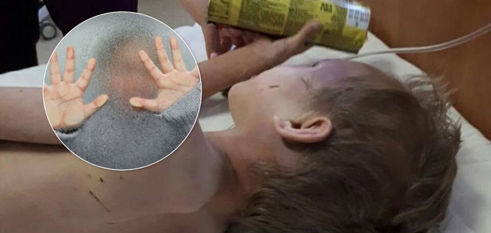 ''Колола голками, морила голодом'': як в Україні знущаються над дітьми і чому влада не діє